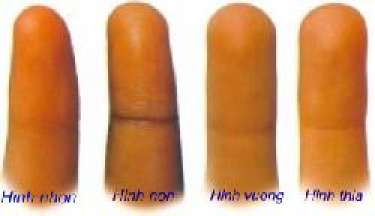 Hình dạng ngón tay