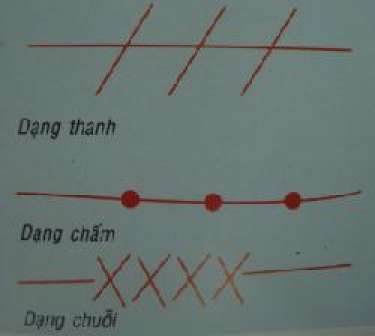 Hình dạng các đường chỉ tay